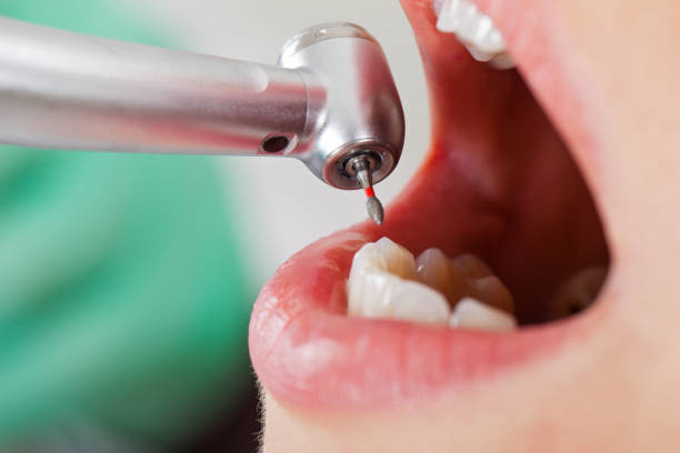 Best Emergency Gum Treatment in Ames, TX